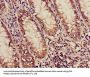 ACADM Antibody