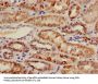 ACADM Antibody