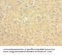 ACADS Antibody