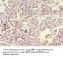 ACADS Antibody