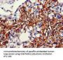 ACADSB Antibody