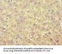ACAT1 Antibody