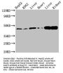 ACAT1 Antibody