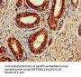ACAT1 Antibody