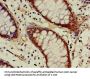 ACAT1 Antibody