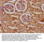 Ace Antibody