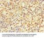 ACLY Antibody