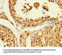ACLY Antibody