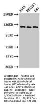 ACLY Antibody