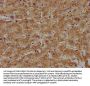 ACOT8 Antibody