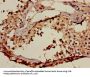 ACRV1 Antibody