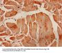 ACTA1 Antibody