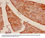 ACTA1 Antibody
