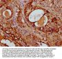 ACTA1 Antibody