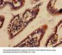 ACTB Antibody