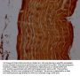 ACTN2 Antibody