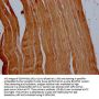 ACTN2 Antibody