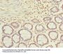 ACTRT1 Antibody
