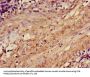 ACTRT1 Antibody