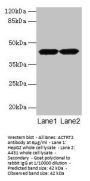 ACTRT2 Antibody