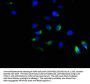 ACVR1B Antibody