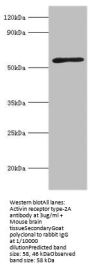 ACVR2A Antibody