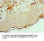 ACVR2A Antibody