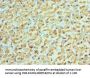 ACVR2A Antibody