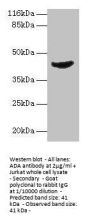 ADA Antibody
