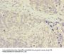 ADA Antibody
