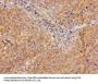 ADA Antibody
