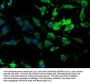 ADA Antibody