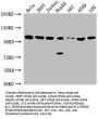 ADAR Antibody
