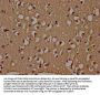 ADAR Antibody