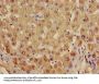 ADH1B Antibody