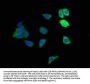 ADH1B Antibody