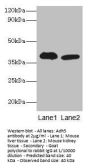 Adh5 Antibody