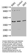 ADIPOR1 Antibody