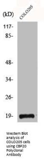 NCBP2 Antibody