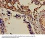 ADM Antibody