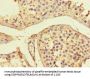 ADORA2A Antibody