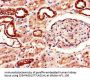 ADORA2B Antibody