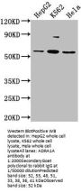 ADRA1A Antibody