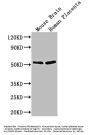 ADRB1 Antibody