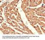 ADRB1 Antibody