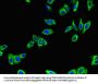 ADRB1 Antibody