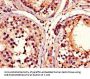 ADRM1 Antibody