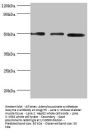 Rabbit anti-human Adenylosuccinate synthetase isozyme 2 polyclonal Antibody(ADSS)