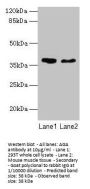 AGA Antibody