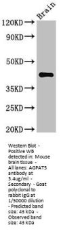 AGPAT5 Antibody